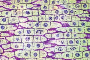 soğan zarı hücresi