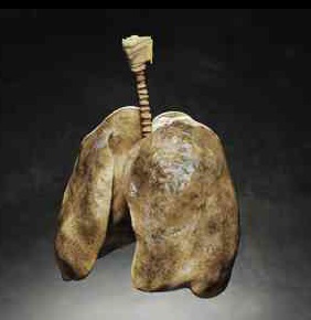 Sigara içen bir kişinin akciğeri