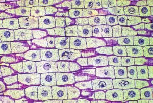 soğan zarı hücresi
